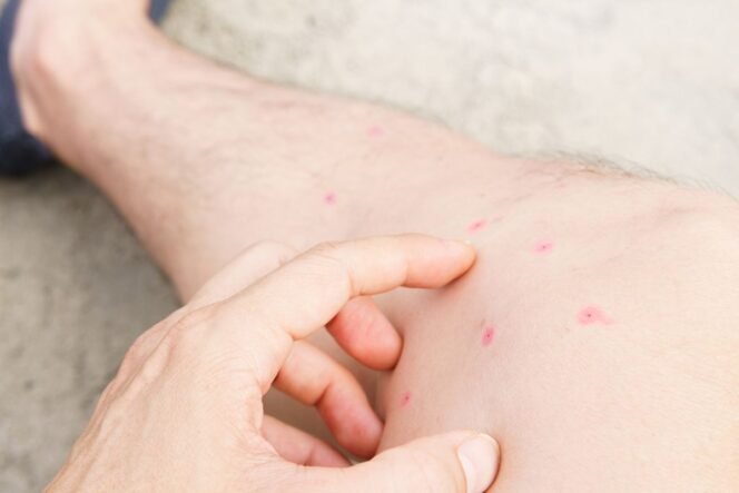 
 Gatal Akibat Kutu Kucing? Kenali Gejala dan Cara Ampuh Mengatasinya!